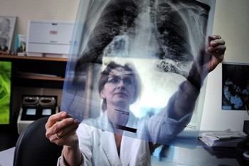 Фотография к новости: США вложили более 20 млн долларов в профилактику туберкулёза в Казахстане