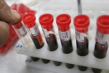 На 10% ежегодно растёт число ВИЧ-инфицированных в Казахстане 