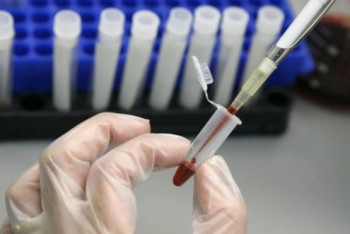 Фотография к новости: В Астане уровень заболеваемости гепатитом А выше, чем по стране