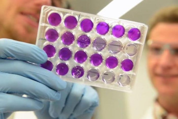 Инновационные лекарства для лечения гепатитов появятся в Казахстане