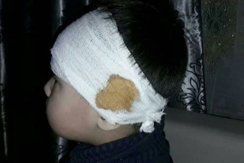 Фотография к новости: 4-летнему мальчику парикмахер порезал ухо в Караганде