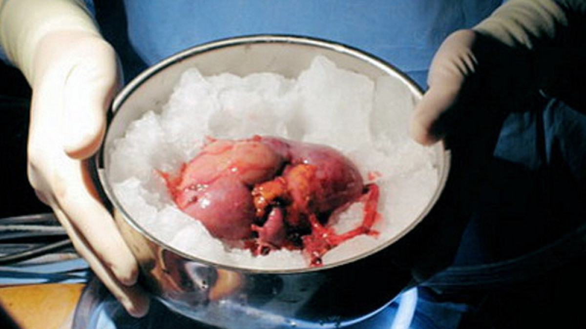 Из открытого источника 