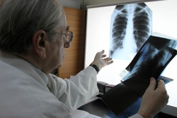 Фотография к новости: В частном детском саду столицы выявлена сотрудница с туберкулезом