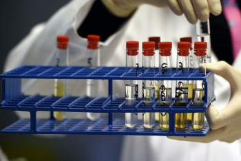 Фотография к новости: В Казахстане за допинговые нарушения спортсменов будут наказывать тренеров 