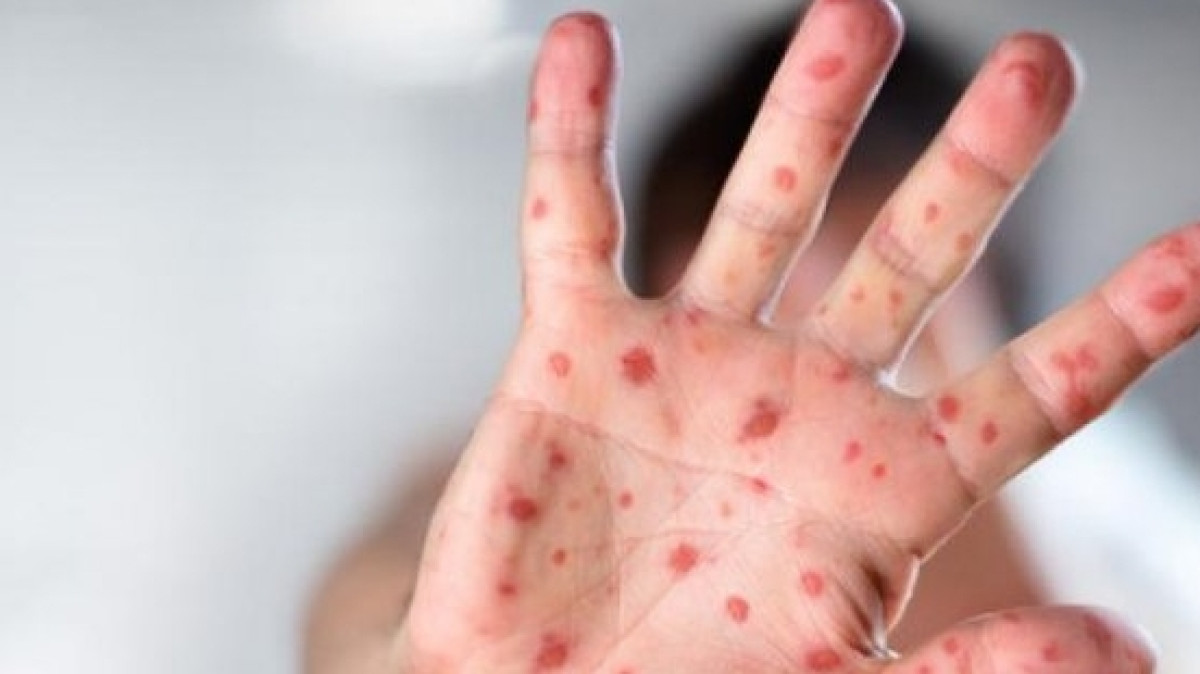 Фото с сайта inform.kz