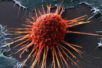 Школьница из Шымкента вывела свою формулу препарата из полыни для лечения рака 