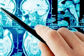 Онкологи и гинекологи ЮКО узнали больше о выявлении рака на ранней стадии