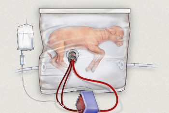 Фотография к новости: Американские ученые создали искусственную матку