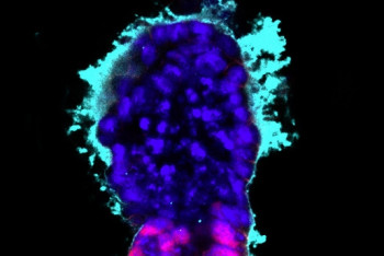 Фотография к новости: Ученым впервые удалось вырастить эмбрион без яйцеклетки