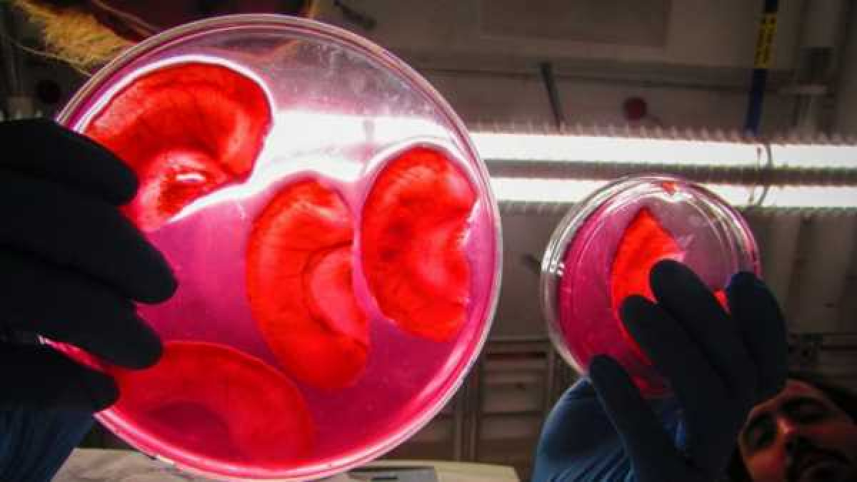 Канадские ученые научились выращивать человеческие уши из яблок