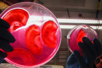 Канадские ученые научились выращивать человеческие уши из яблок