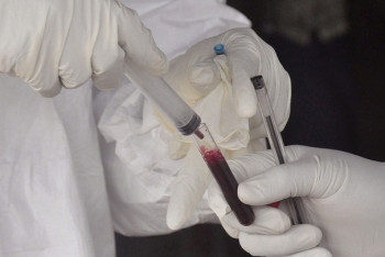 Фотография к новости: ВОЗ завершила испытания вакцины против вируса Эбола