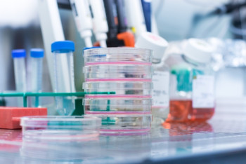 Фотография к новости: Обнародованы результаты внепланового отбора проб в Арыси