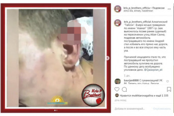 Фотография к новости: Алматинец откусил часть уха не пропустившему его водителю