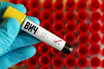 Фотография к новости: Начались масштабные испытания вакцины против ВИЧ