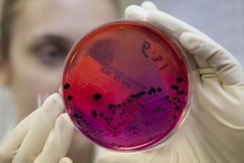 Карантин из-за сибирской язвы в селе Ольгинка снимут 3 сентября