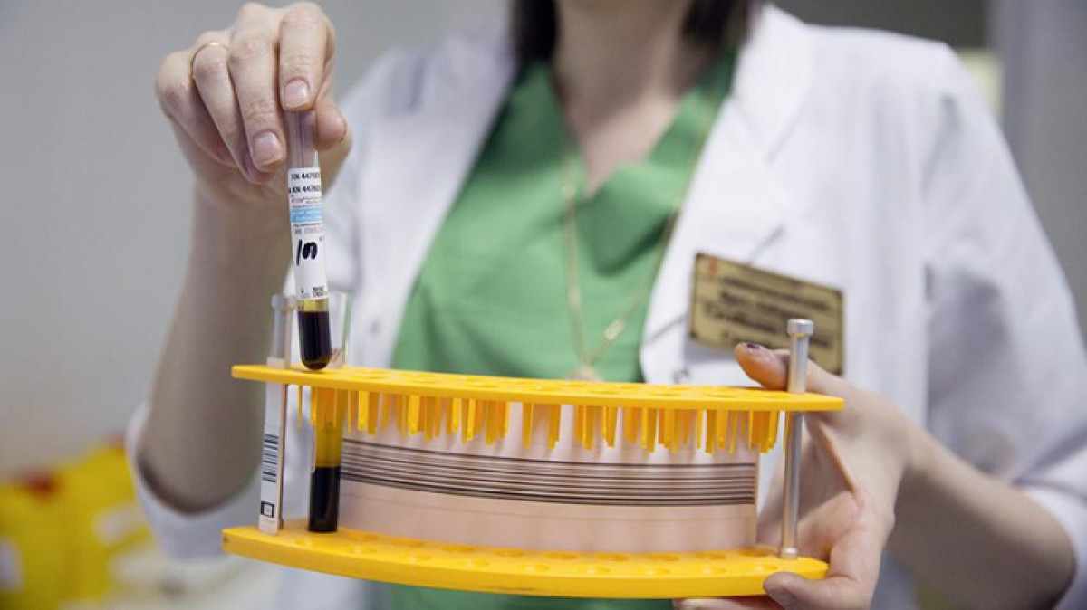 Онколог назвала 12 основных симптомов рака