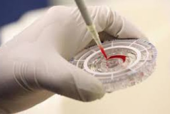 Фотография к новости: Крымская лихорадка разразилась на Ставрополье