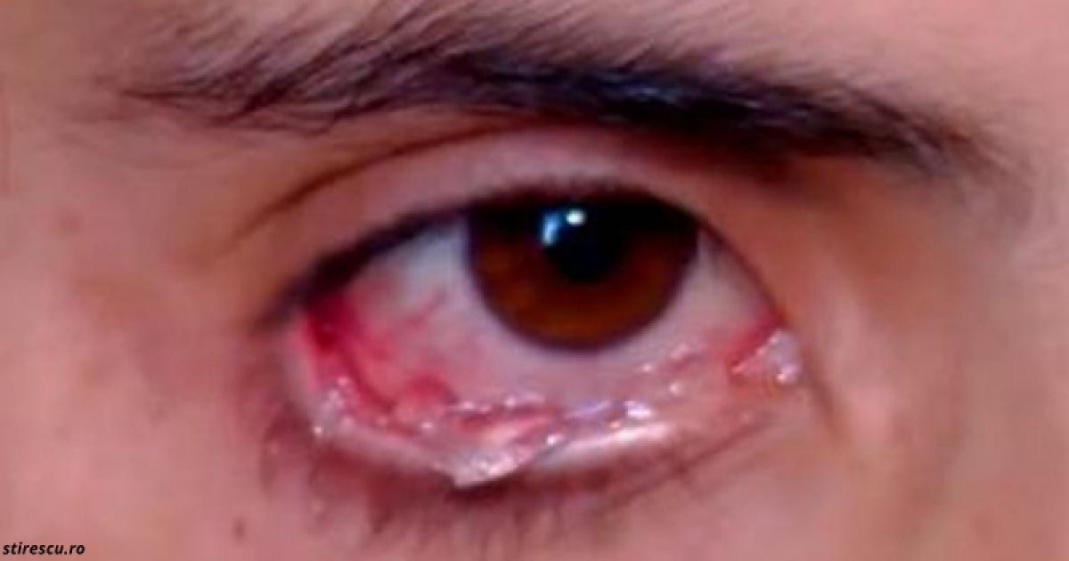 В Армении живёт девушка, которая плачет хрустальными слезами