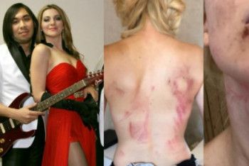 Фотография к новости: О ходе расследования дела по избиению певицы Ашигалиевой рассказали в полиции