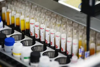 Фотография к новости: Новый штамм ВИЧ обнаружен учеными