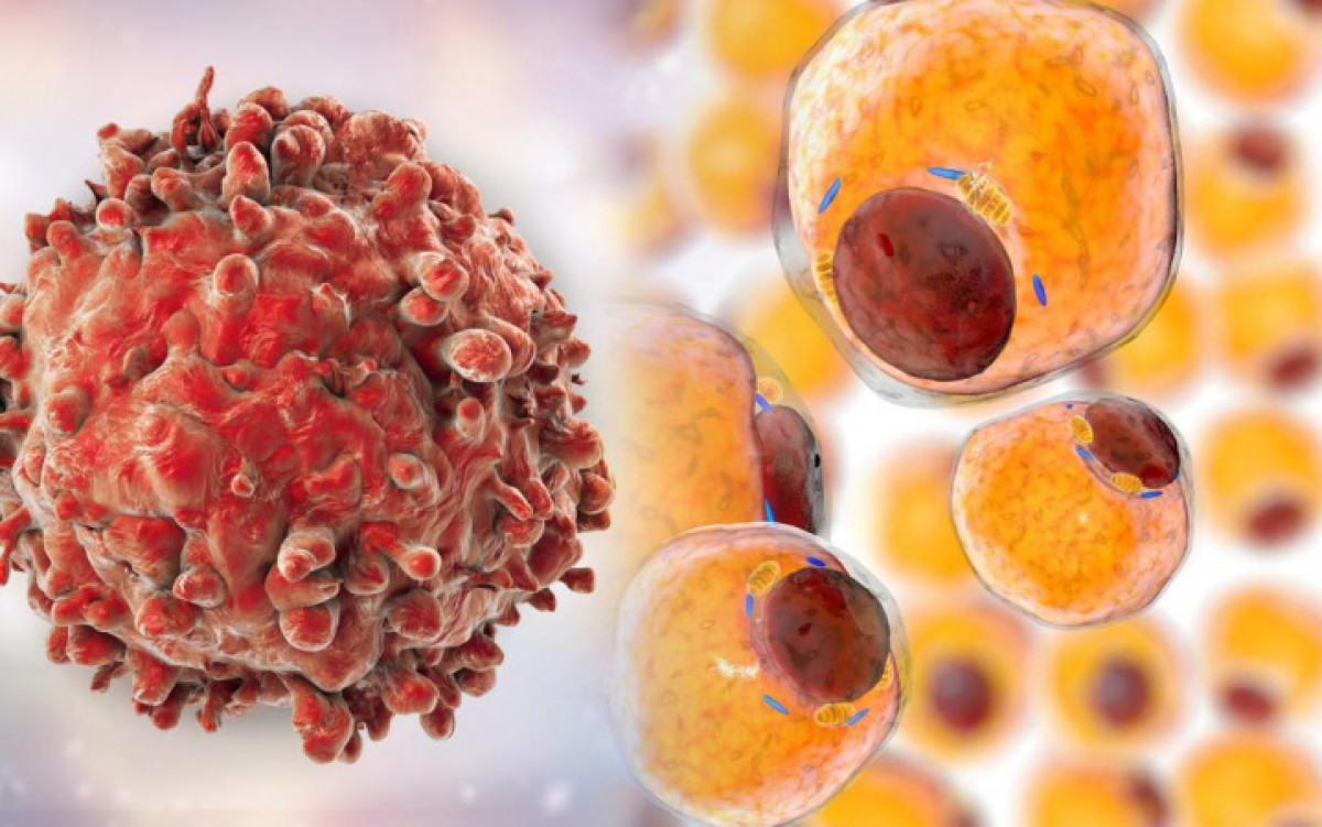 Library/Getty Images/Indicator.Ru