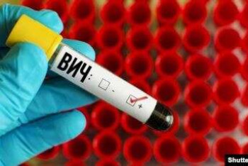 Фотография к новости: ВИЧ чаще стали находить у женщин в Нур-Султане 