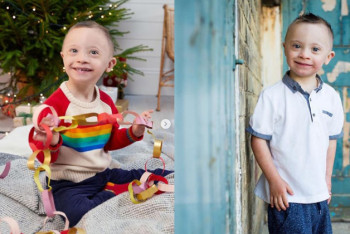 Фотография к новости: Ребенок с синдромом Дауна стал моделью в Британии