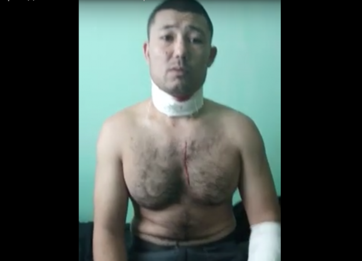 Осужденные с порезанным горлом жалуются на беспредел в колонии поселка Заречного в Алматинской области