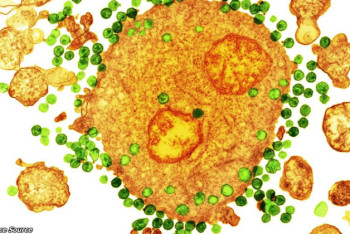 Фотография к новости: От ВИЧ вылечили второго человека