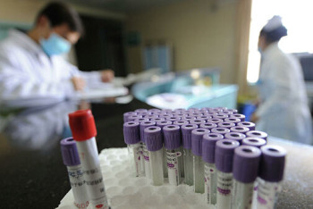 Фотография к новости: Минздрав обратился к казахстанцам из-за вспышки пневмонии в Китае