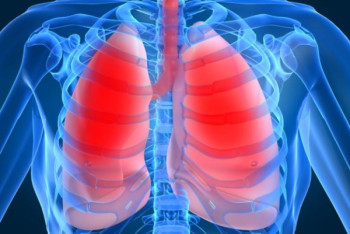 Фотография к новости: Как казахстанцам не заболеть пневмонией