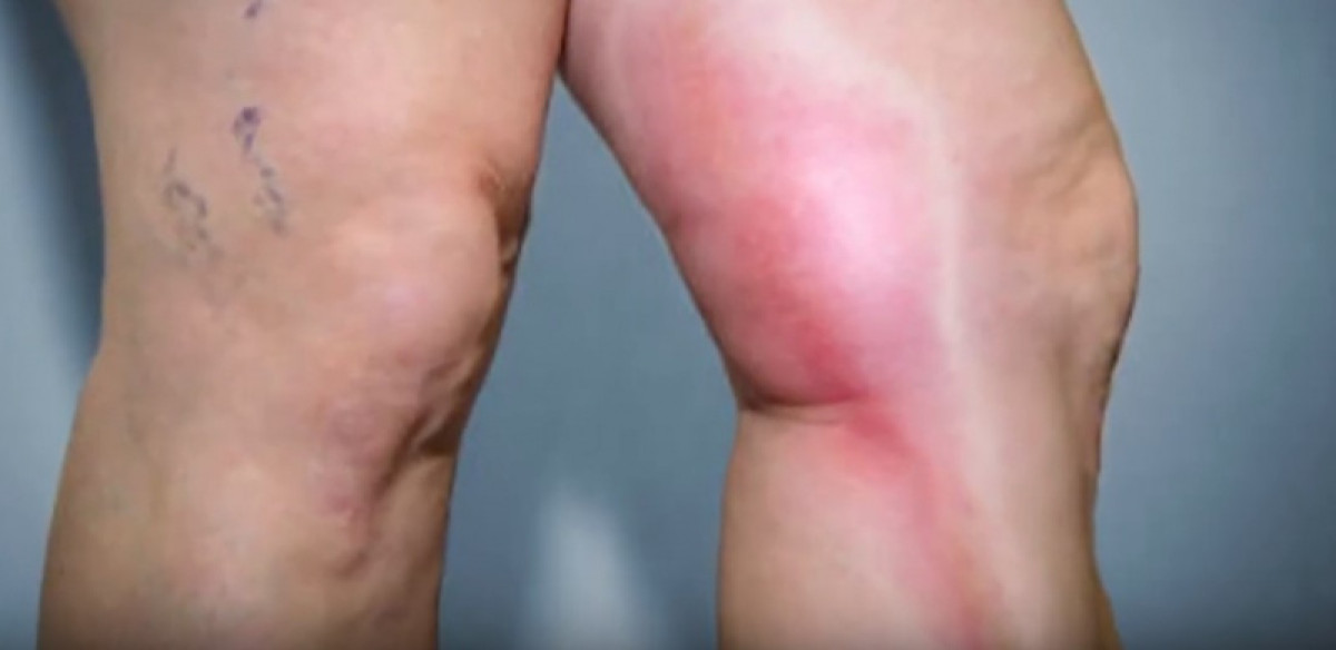 кадр из видео