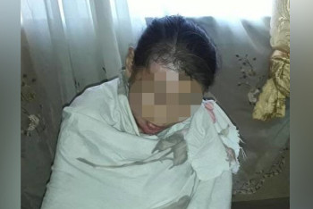 Фотография к новости: Муж избил жену до потери сознания и облил кипятком в Кыргызстане