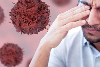 Фотография к новости: Врачи назвали три необычных признака рака легких на лице