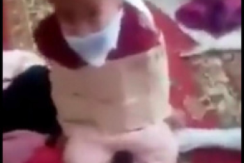 Фотография к новости: "Связанного мальчика" из Туркестанской области госпитализировали в больницу