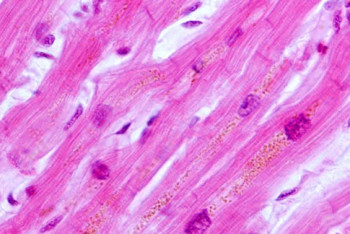 Фотография к новости: Впервые проведена успешная трансплантация сердечных мышц, выращенных в лаборатории