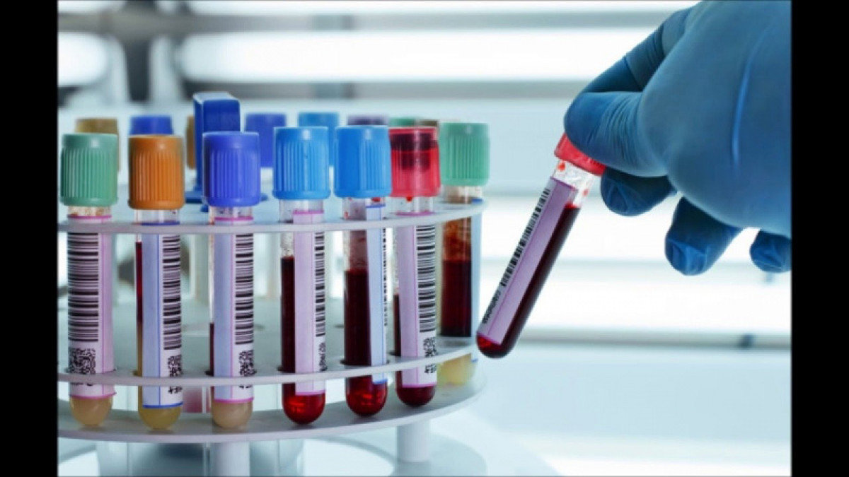 Как проводят диагностику коронавируса в Казахстане, рассказал Биртанов