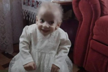 Фотография к новости: Восьмилетняя девочка умерла от старости в Украине