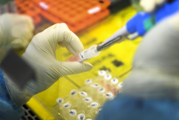 Фотография к новости: Число заразившихся коронавирусом превысило 98 тысяч, умерли 3385 человек