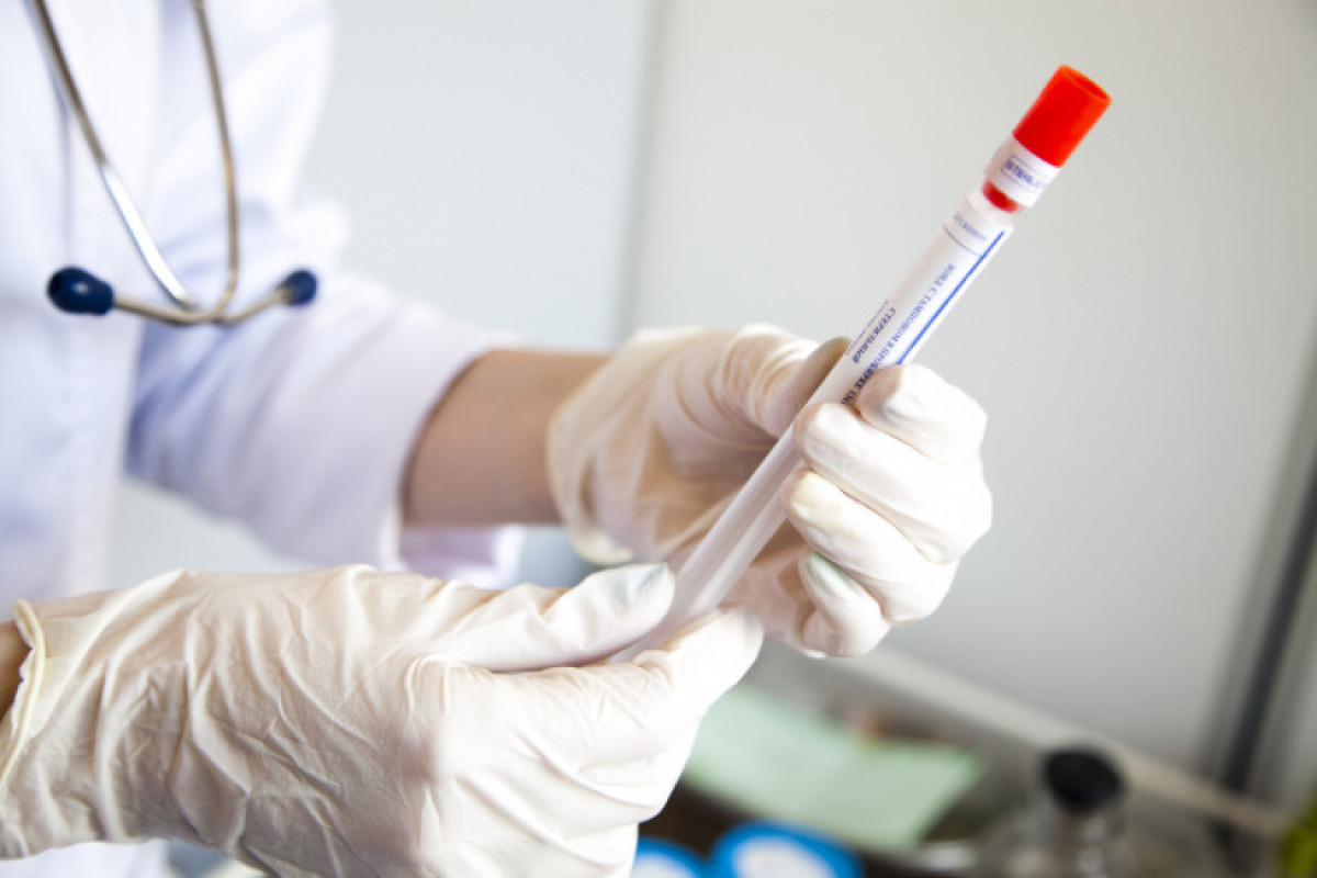 Уже девять: коронавирус выявлен у 12-летней девочки в Алматы