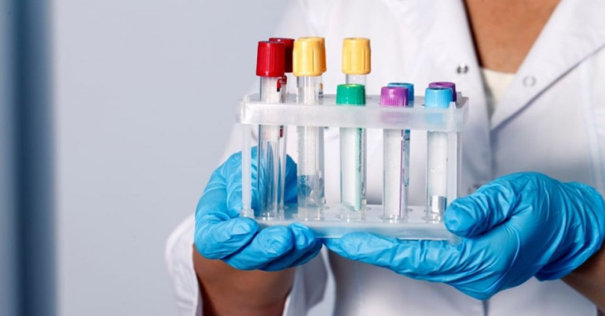 Когда будут проводить экспресс-тесты на коронавирус в Нур-Султане