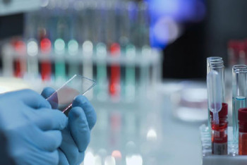 Фотография к новости: О состоянии госпитализированного с подозрением на коронавирус таксиста рассказали санврачи