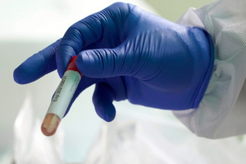 Фотография к новости: Еще три случая заражения COVID-19 зарегистрировано в Акмолинской области