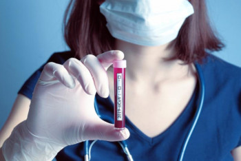 Фотография к новости: Еще пять случаев заражения коронавирусом зафиксировано в Казахстане