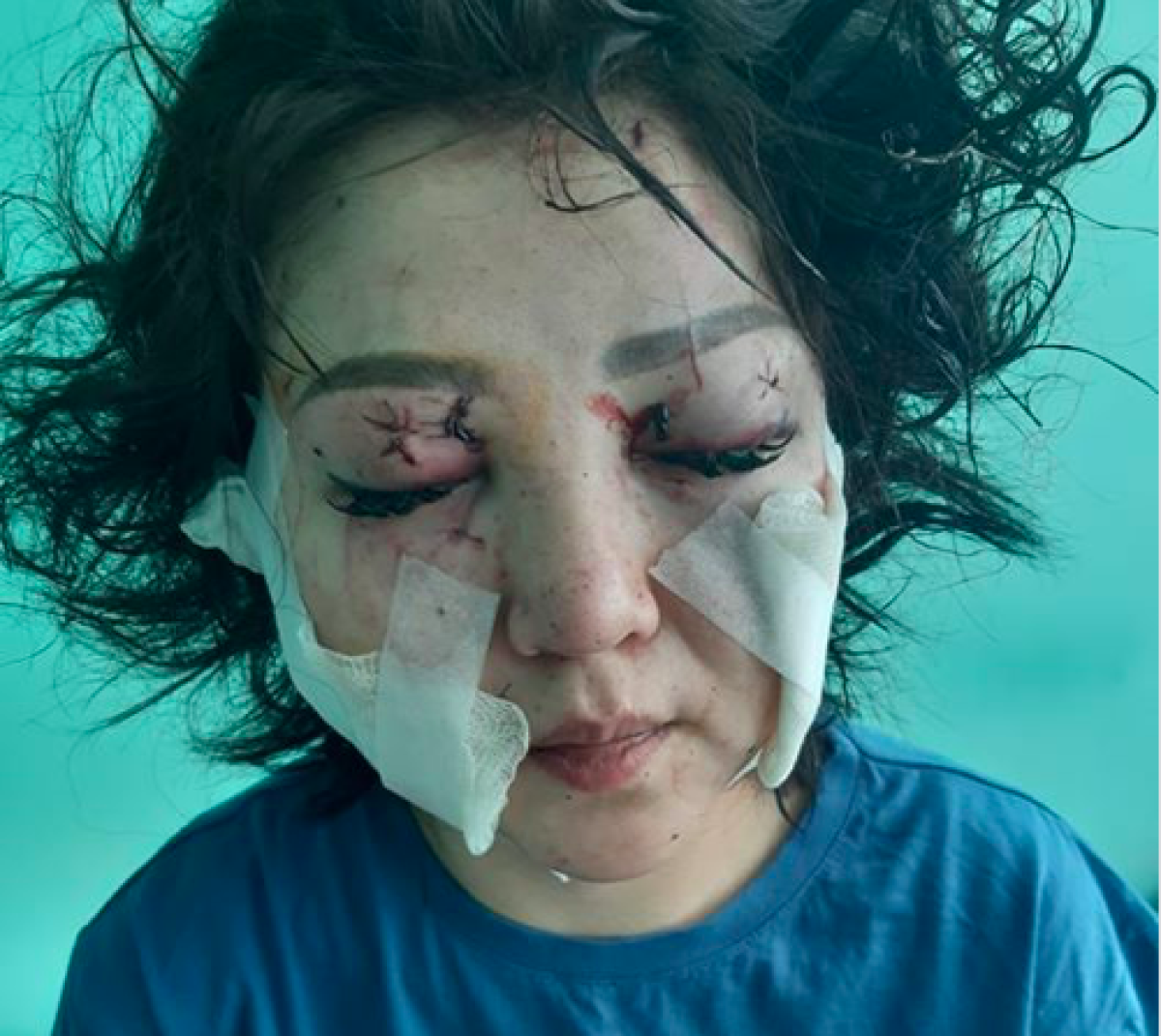 "Разрезал лицо от уха до рта". Мужчина изувечил бывшую жену в Актобе