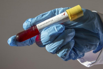 Почему ни одного случая заражения COVID-19 нет в Костанайской области, рассказал глава Минздрава