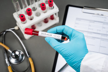 Фотография к новости: В Кызылординской области выявлены 12 случаев заражения коронавирусом