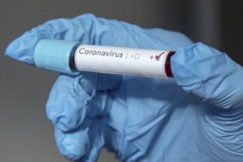 Фотография к новости: Еще девять случаев заражения коронавирусом зарегистрированы в Кызылординской области