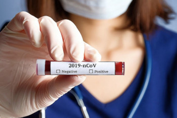 Фотография к новости: Еще четыре случая заражения коронавирусом зафиксировано в Казахстане